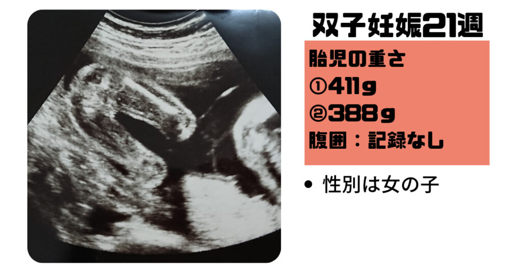 一卵性の双子妊娠 妊娠5週から38週までの私のお腹とエコー写真を大公開 あみろぐ
